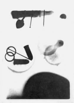 Three students at Davidson College surreptitiously made this X-ray of several objects, including the finger of a cadaver (top), on 12 Jan. 1896. Their X-ray is thought to be the first made in the South. Courtesy of the Davidson College Archives.